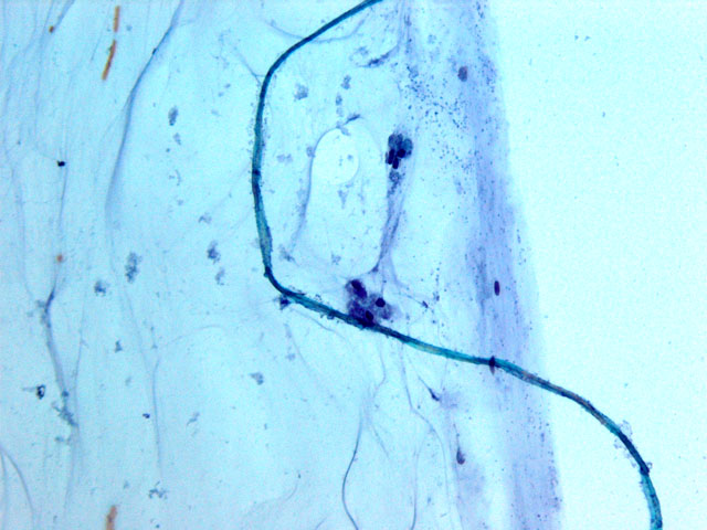 Figura 3. Fibra vegetal